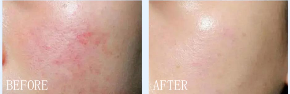 After-Sun Repair Liquid